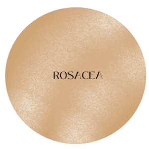 Rosacea